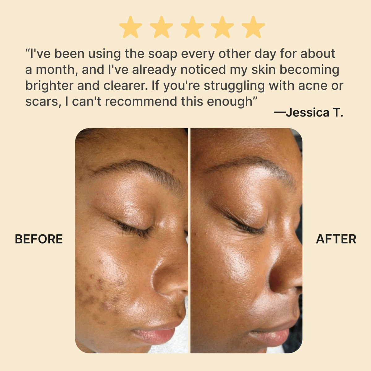 African Black Soap - Bonus Bar