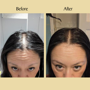 Before and after images showing reduced hair thinning on top of a woman's head.