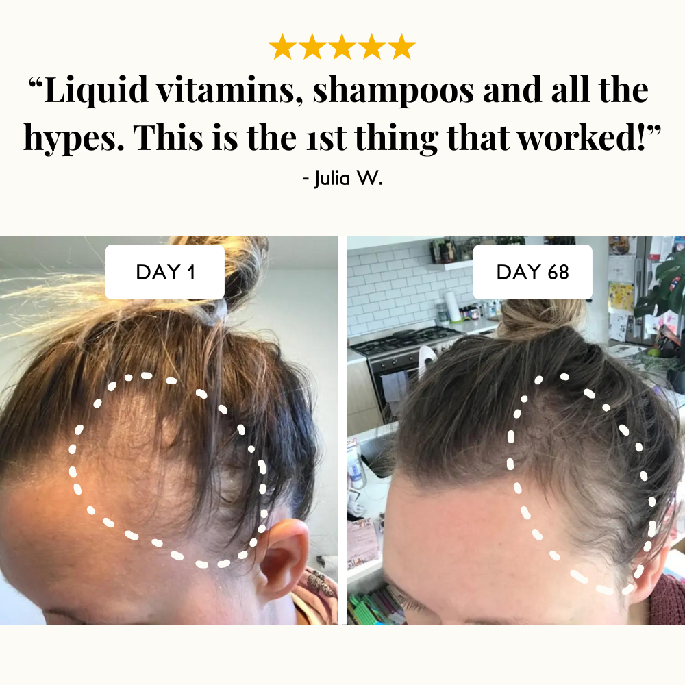 Ultra-Fast Growth Oil for Thinning Hair