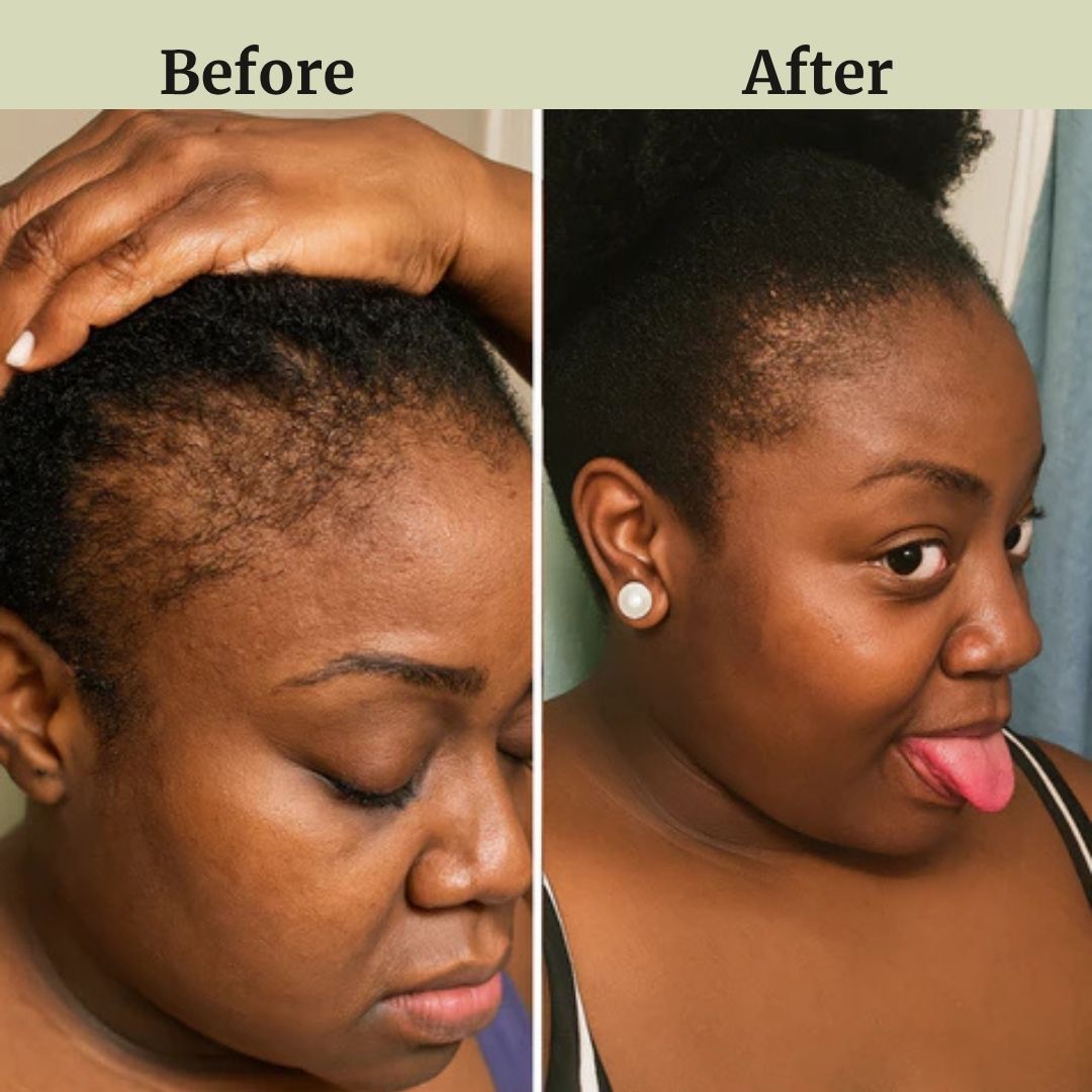 Deep Root Hair Oil Applicator + FREE Hair Growth Oil
