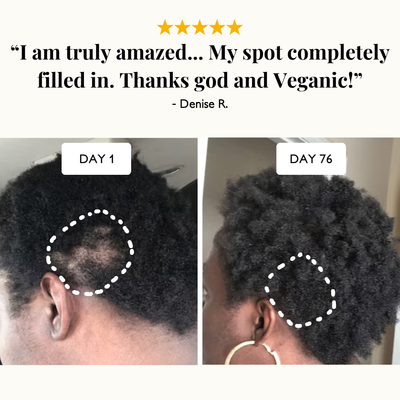Veganic Natural Hair Growth Oil (Froya)