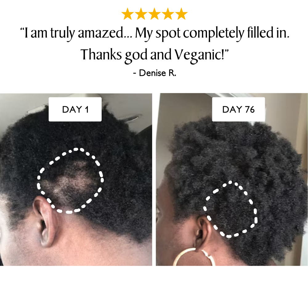 Batana & Jamaican Black Castor Extreme Growth Oil