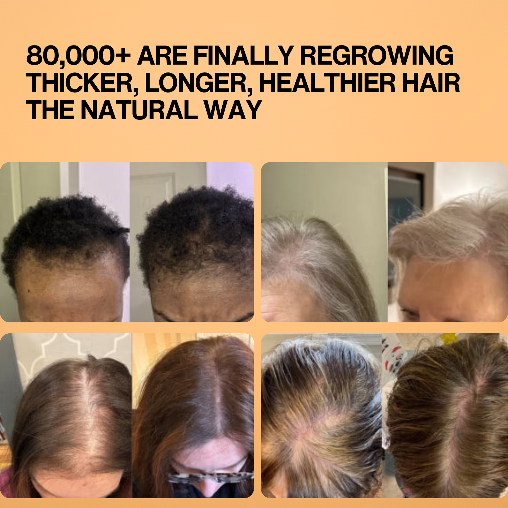 ULTRAFAST HAIR GROWTH KIT