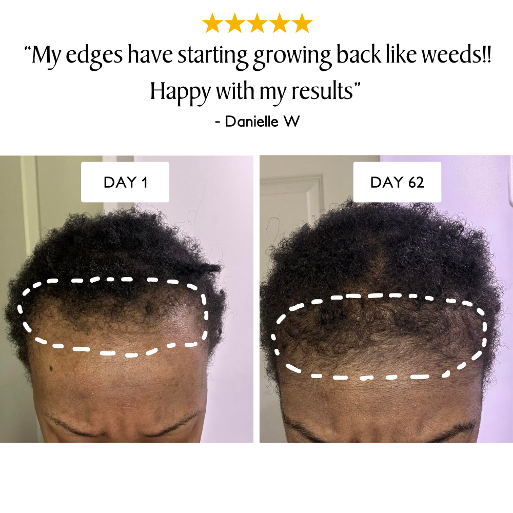 Batana & Jamaican Black Castor Extreme Growth Oil