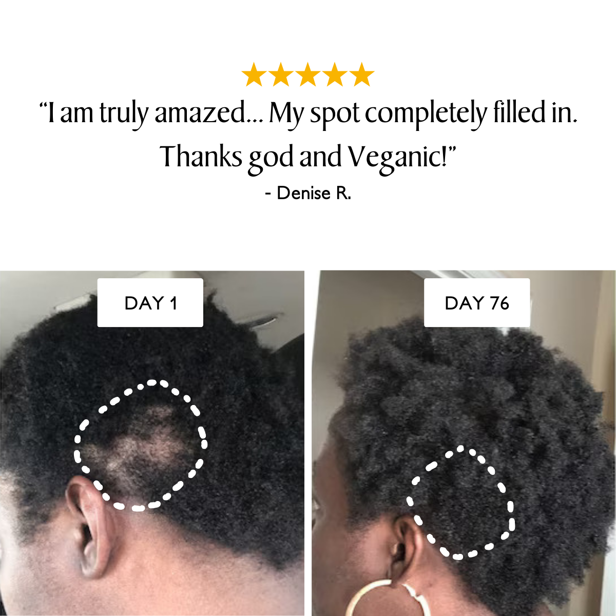 Rosemary Hair Growth Capsules