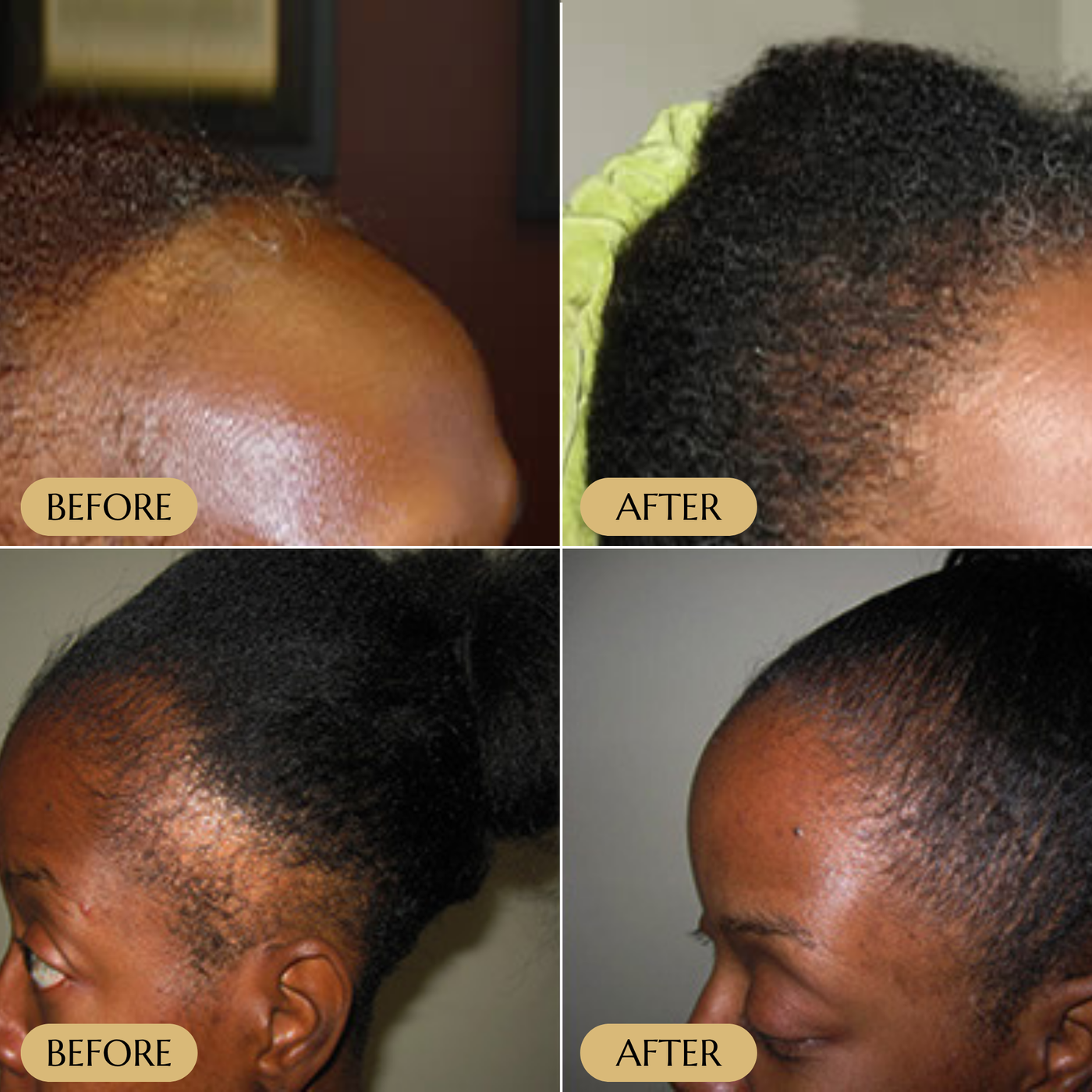 Veganic Hair Growth Serum