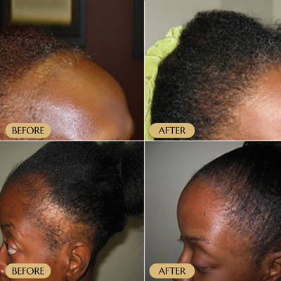 Veganic Hair Growth Serum