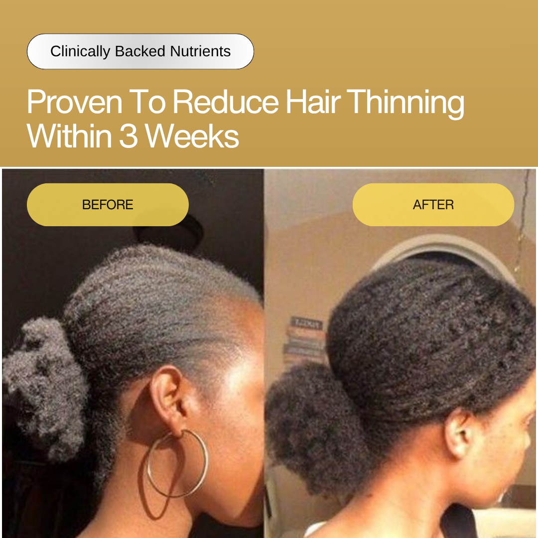 11-in-1 Hair Growth Oil