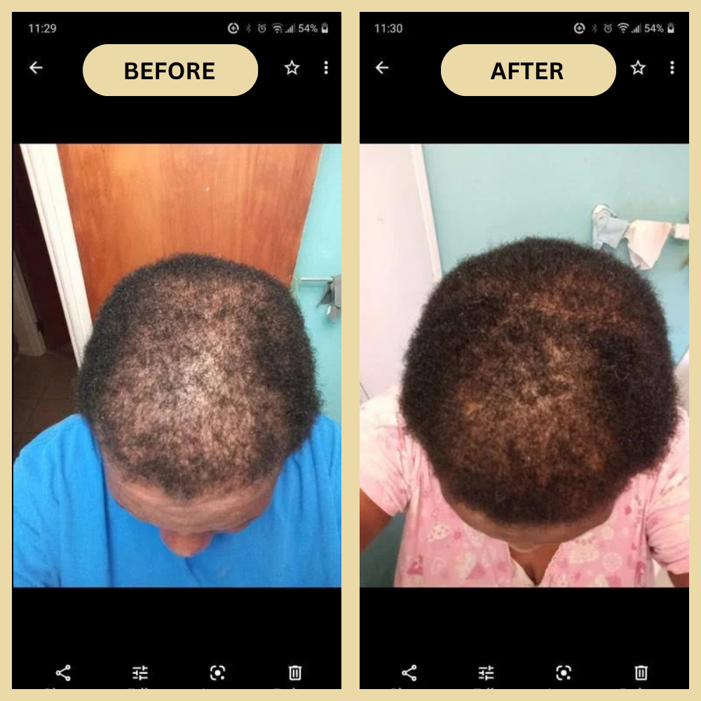 Early Black Friday Sale - Veganic Natural Hair Growth Oil