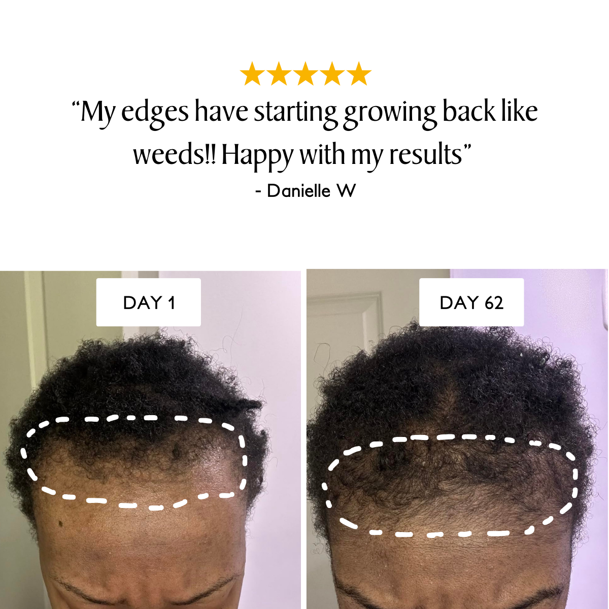 Veganic Natural Hair Growth Oil - Flash Sale