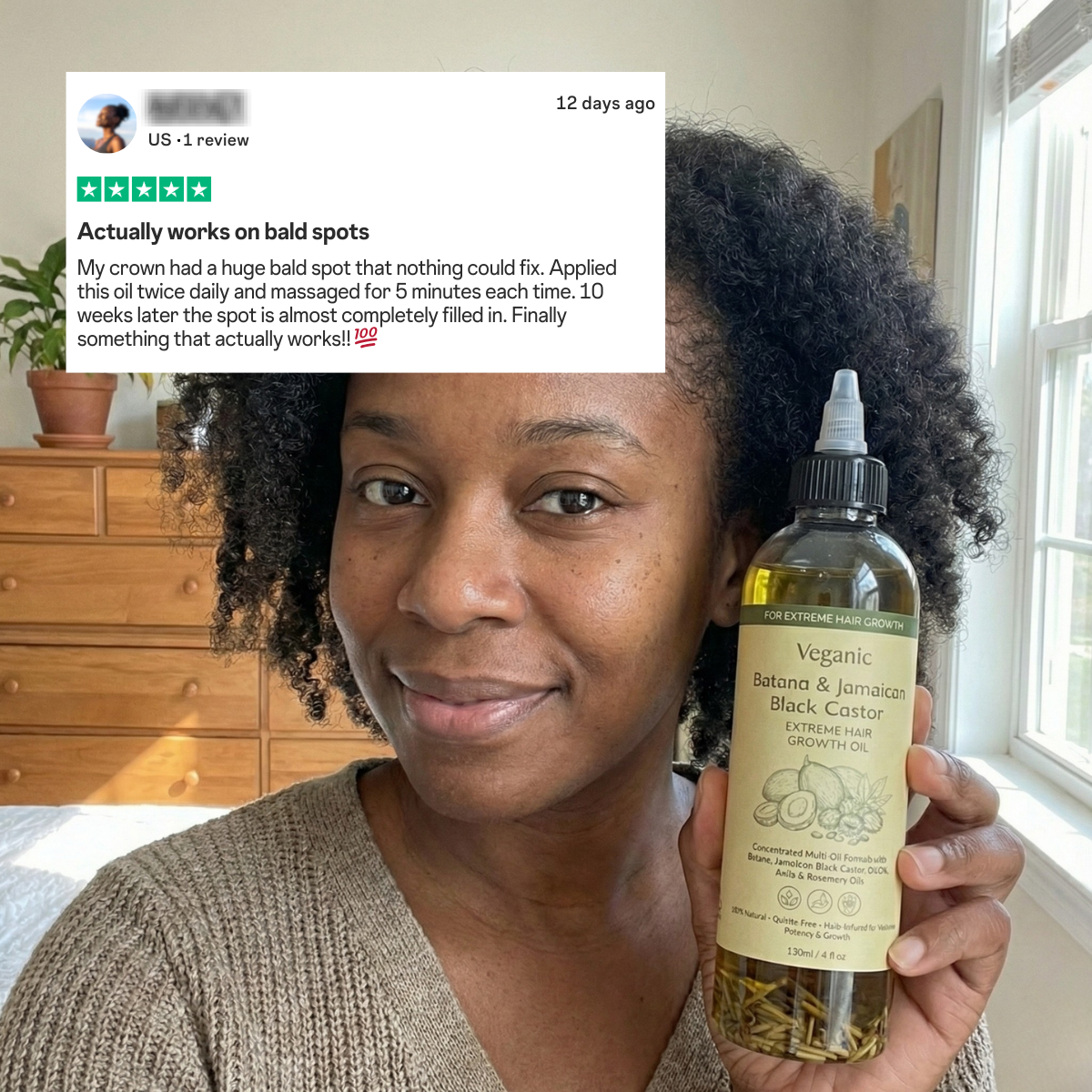 Batana & Jamaican Black Castor Extreme Hair Growth Oil