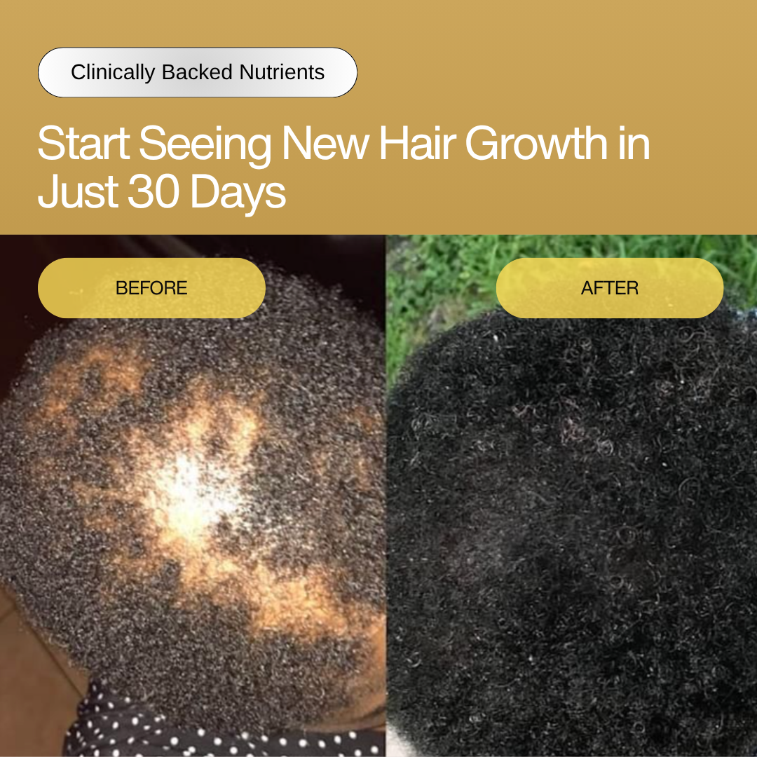 11-in-1 Hair Growth Oil