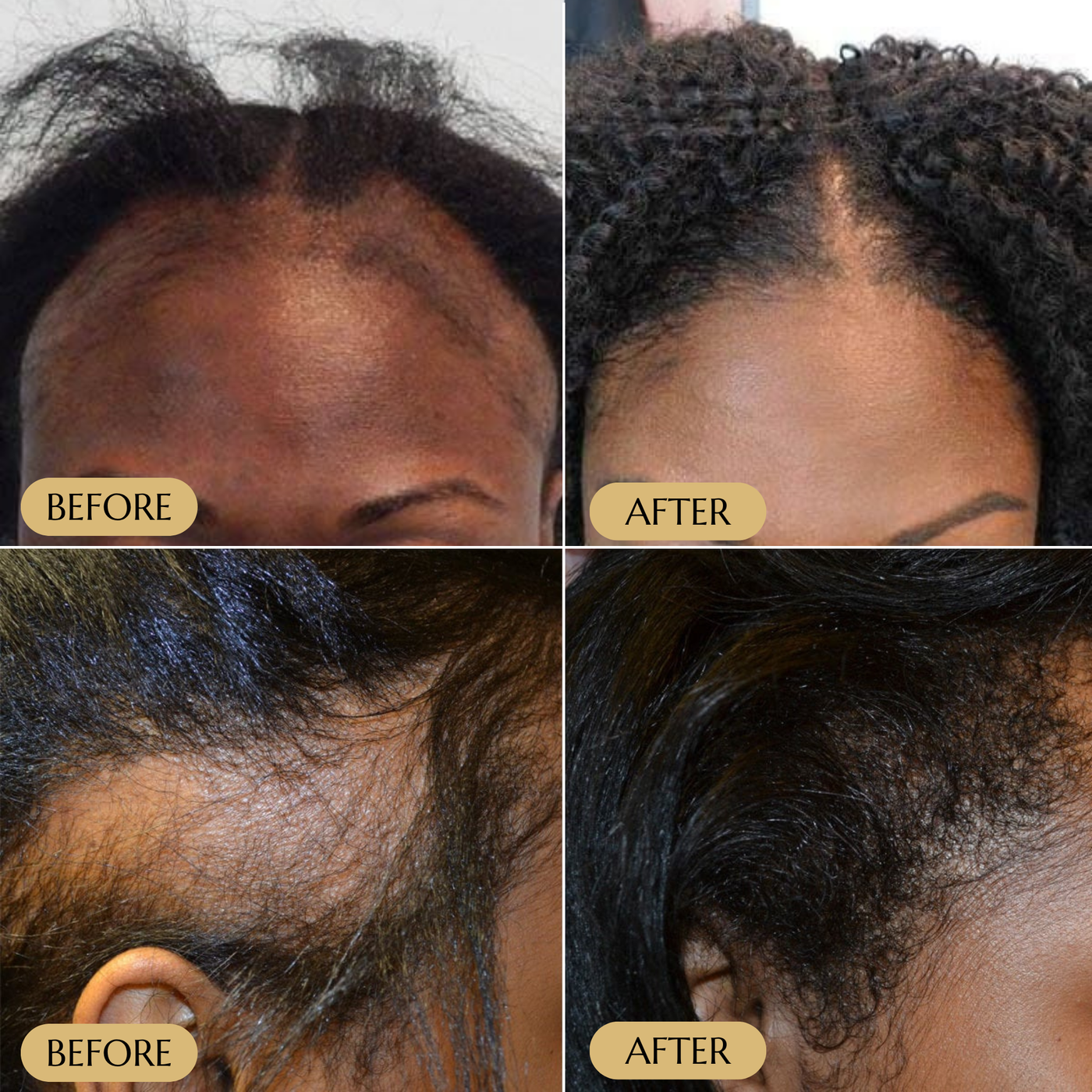 Veganic Hair Growth Serum
