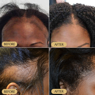 Veganic Hair Growth Serum