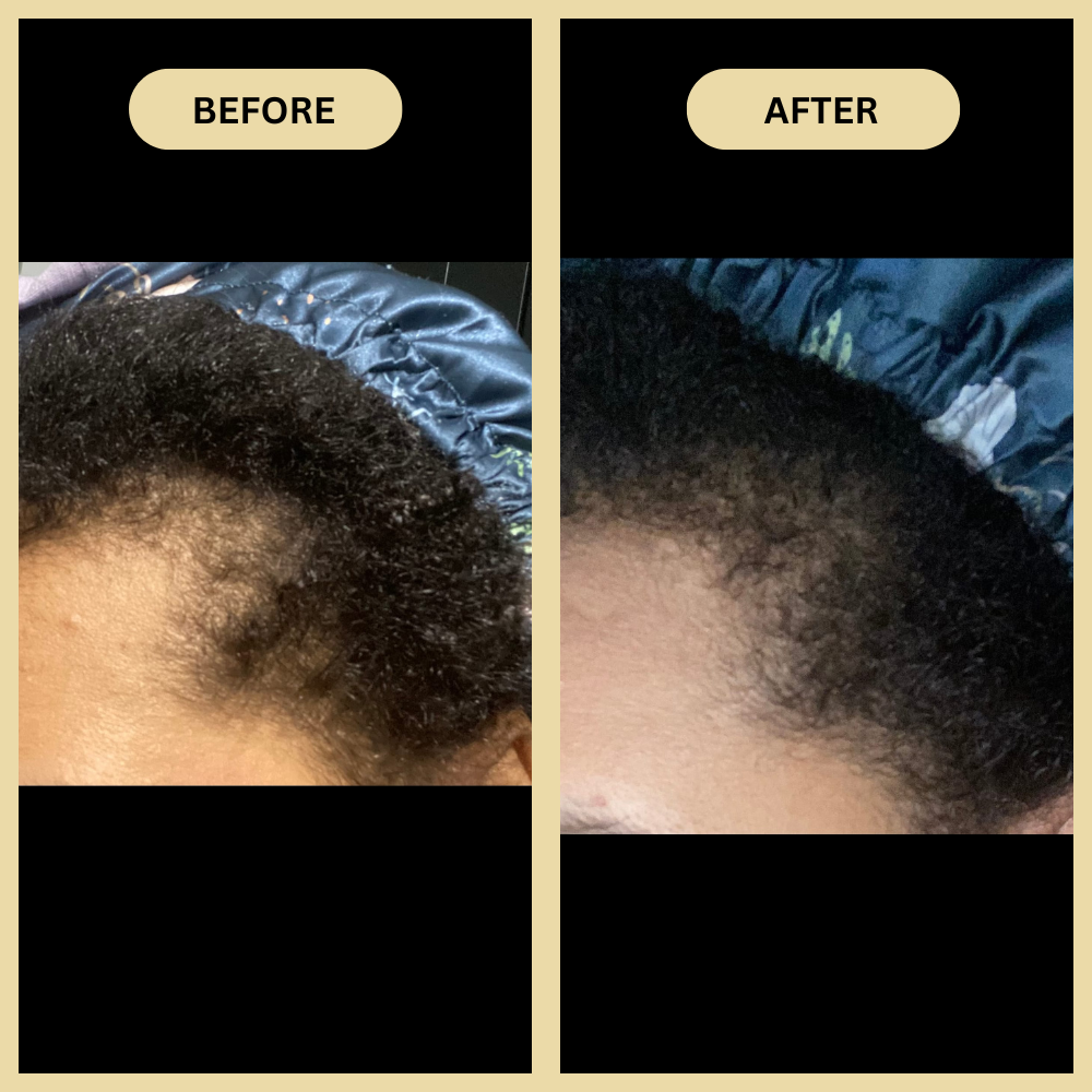 Early Black Friday Sale - Veganic Natural Hair Growth Oil