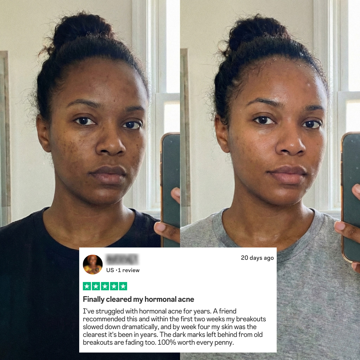 African Black Soap & Kojic Acid Dark Spot Removal Duo