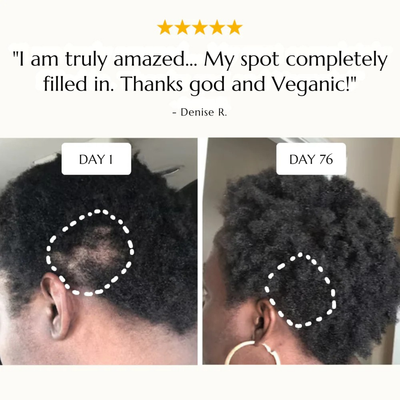 Rosemary Roll-On Hair Growth Serum