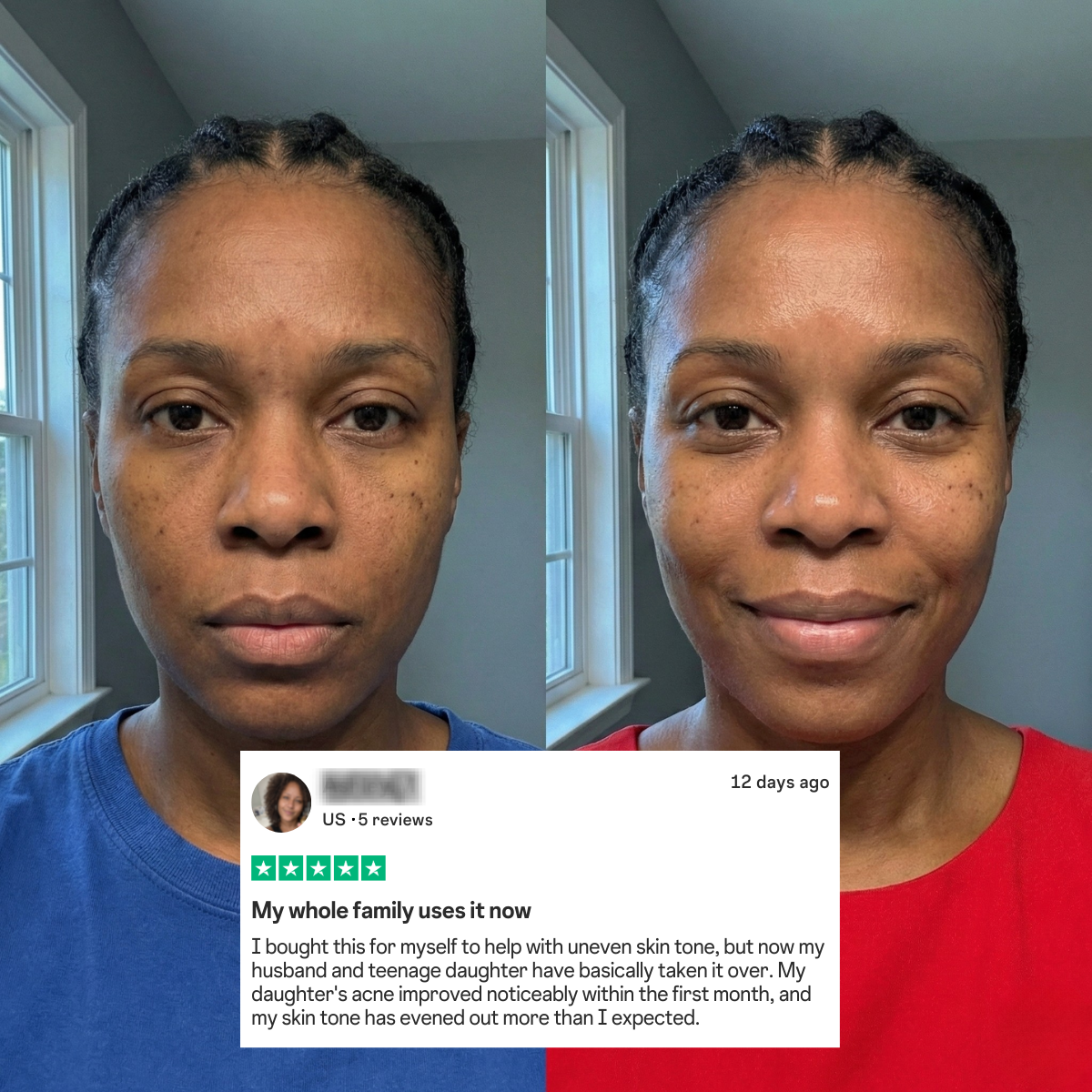 African Black Soap & Kojic Acid Dark Spot Removal Duo