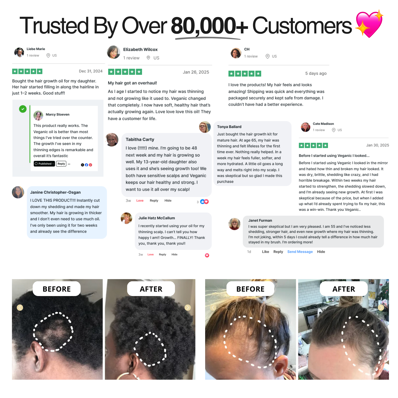 ULTRAFAST HAIR GROWTH KIT