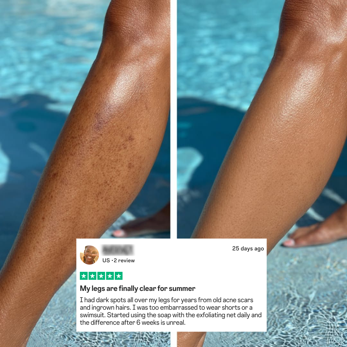Complete Skin Transformation Bundle