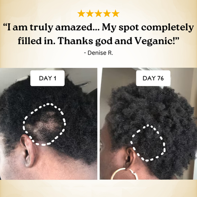 Veganic Natural Hair Growth Oil