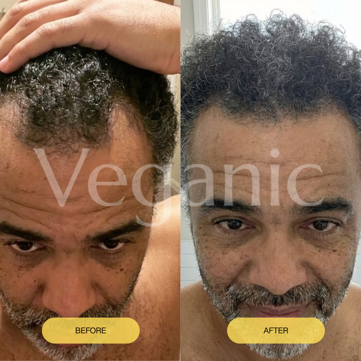 Early Black Friday Sale - Veganic Natural Hair Growth Oil