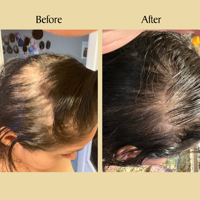 Veganic Enhanced Hair Growth Oil
