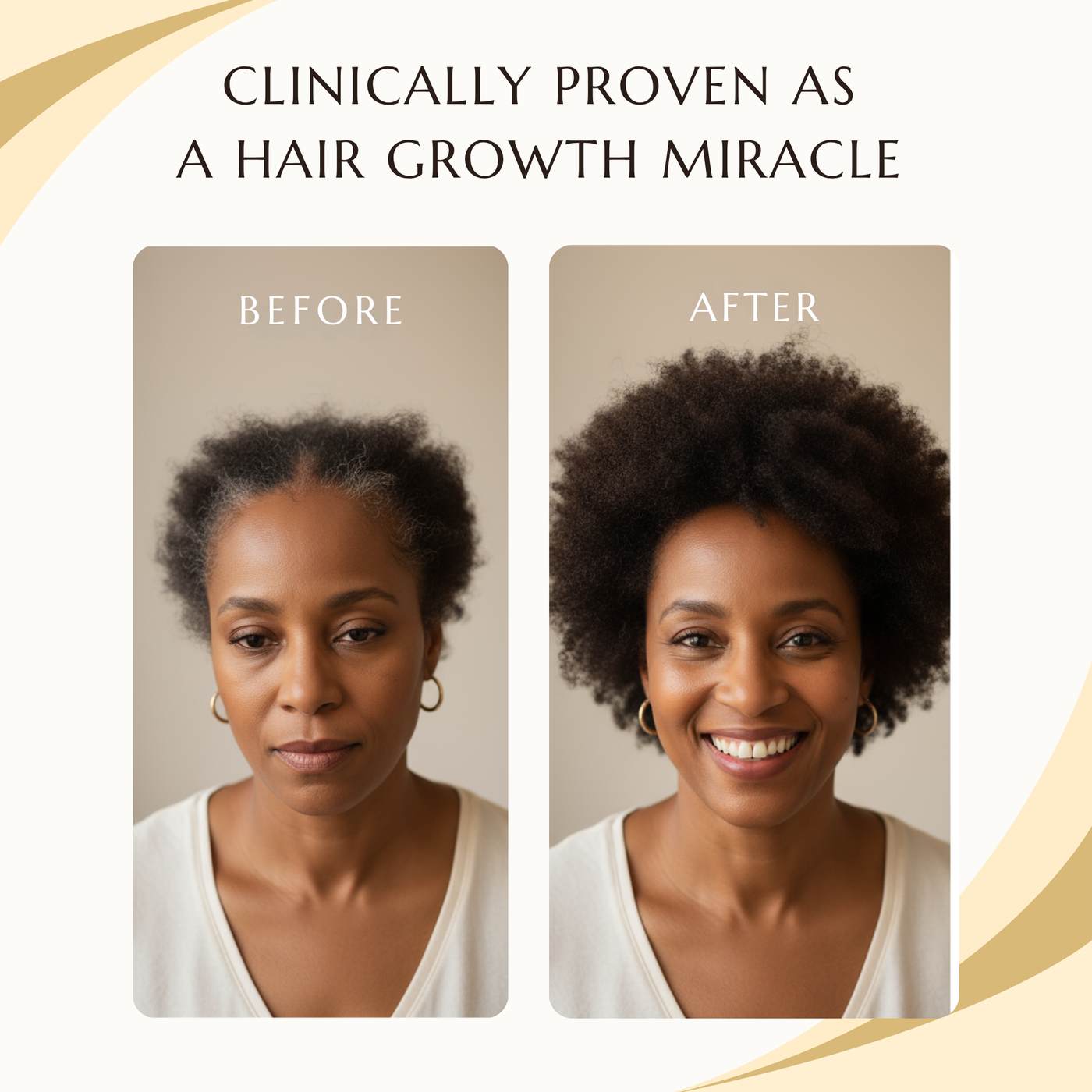 Rosemary Roll-On Hair Growth Serum