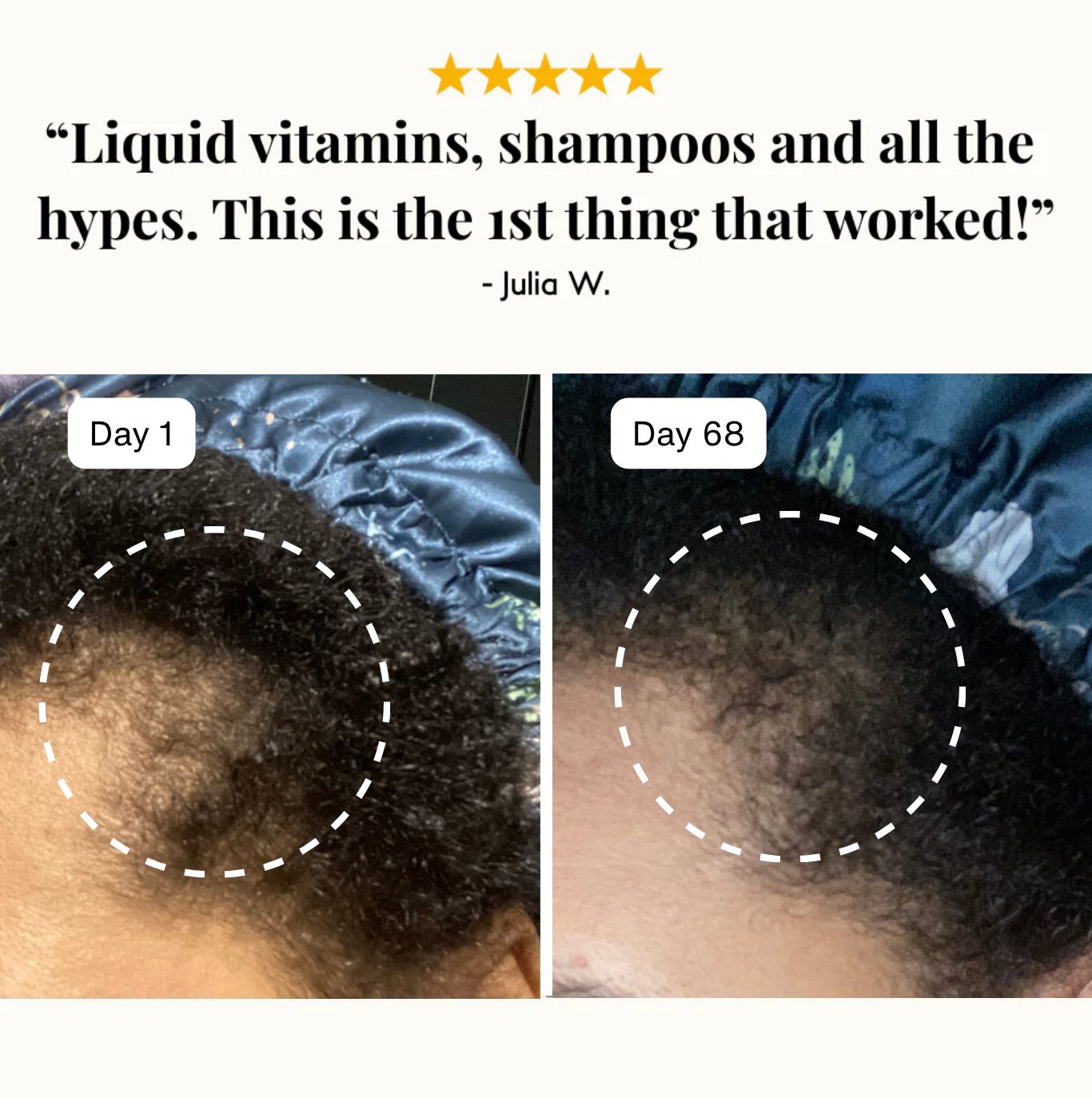 Ultra-Fast Growth Oil for Thinning Hair