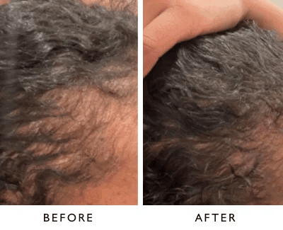 Veganic Hair Growth Serum